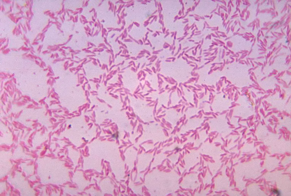 Your Gut Is Older Than You Think – 13 Ancient Creatures Living Inside You